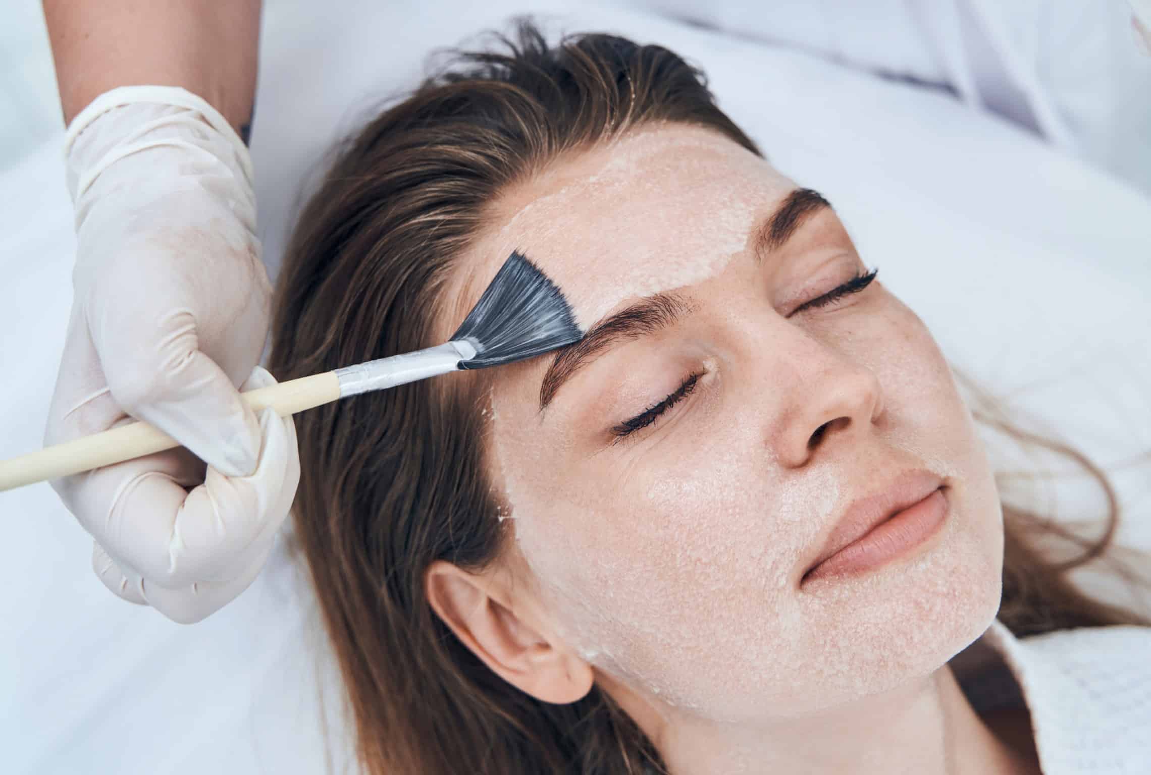 Peeling visage : les tarifs | peeling chimique visage | Dermatologie esthétique lasers | Amiens