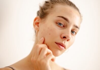 Traitements des imperfections cutanées