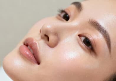 Microneedling et radiofréquence | Dr Tribout | Amiens